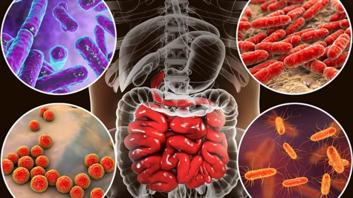Segédlet a megfelelő probiotikum kiválasztáshoz